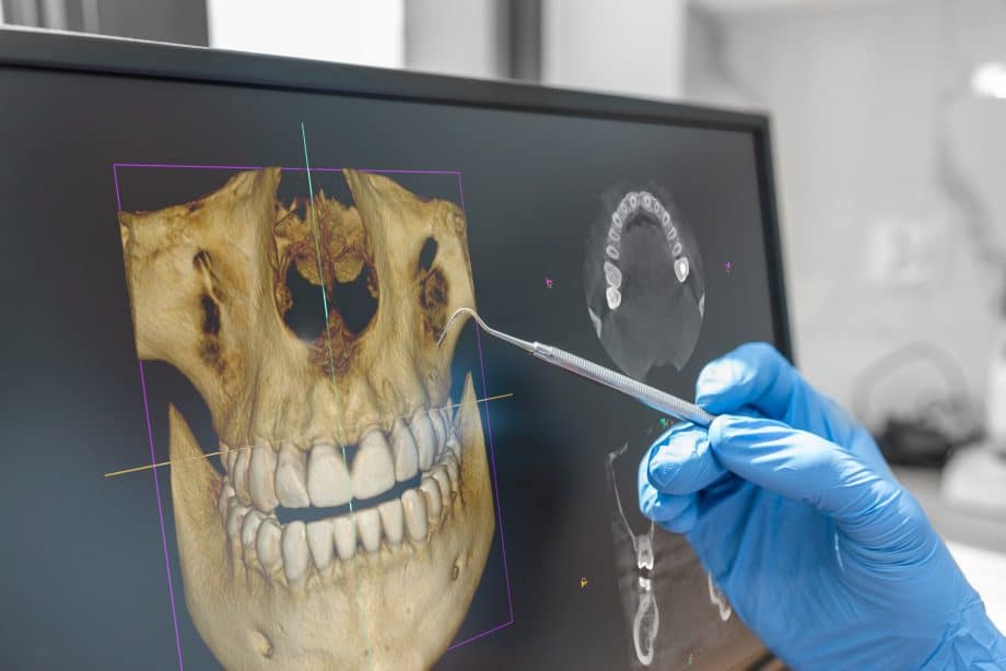 3D CBCT Imaging at Community Oral and Maxillofacial Surgery in Milwaukee, WI