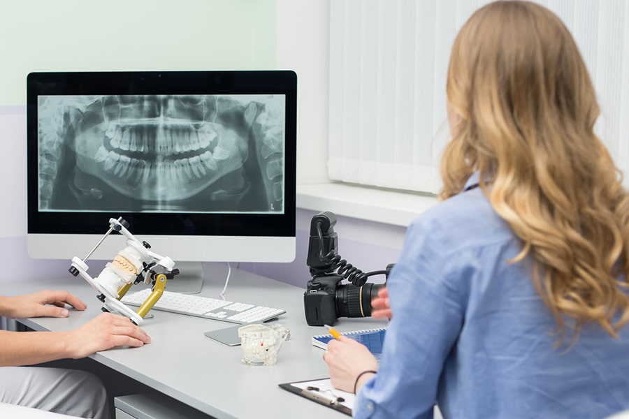 Mini Dental Implants (MDIs) illustration