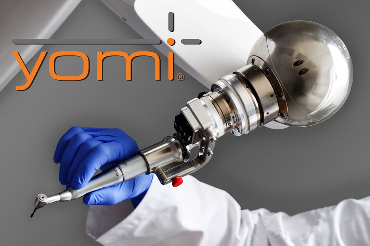 YOMI Robotic Assisted Dental Implants Milwaukee, WI